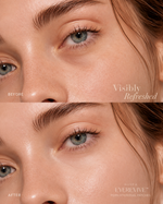 Alivea EyeRevive™ PDRN Hydrogel Patches