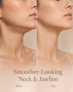 Alivea Neck & Jawline Micro-Lift Patch